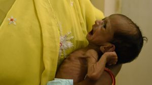 Ein unterernährtes Kind in Indien. Rund 15 000 Kinder unter fünf Jahren sterben nach Angaben der Vereinten Nationen jeden Tag auf der Welt. Foto: AFP