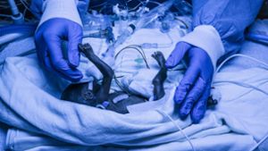 Ein Frühchen wird von  einer Pflegekraft versorgt: Dank spezieller medizinischer Einrichtungen in Reutlingen haben auch zu früh geborene Babys gute Überlebenschancen Foto: Andy Reiner