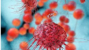 Wuchernde Gefahr: Krebszellen im Mikroskop. Foto: fotoliaxrender