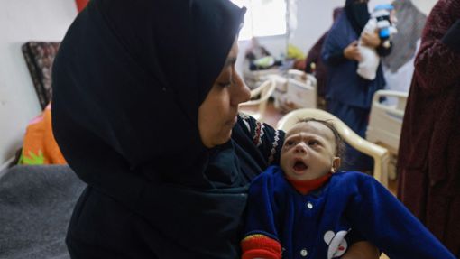 Ein unterernährtes Kind wird in Rafah in einer Krankenstation behandelt. (Archivbild) Foto: AFP/MOHAMMED ABED