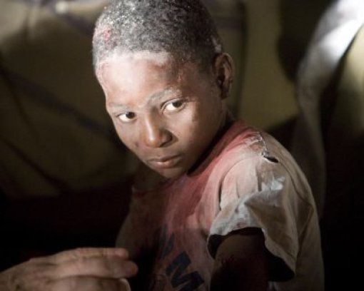 Ein Kind im Chaos einer Katastrophe: Der verletzte Junge musste in Port-au-Prince auf Haiti das stärkste Erdbeben seit 200 Jahren miterleben. Foto: AP