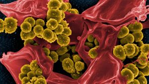 Multiresistenter Keim: Das Bakterium Staphylococcus aureus (gelb)zerstört menschliche Blutzellen (rot). Foto: Imago/BSIP