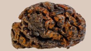 Dieses Gehirn ist auch nach 1000 Jahren erhalten geblieben. Es stammt aus einem Grab auf dem Friedhof der Sint-Maartenskerk im belgischen Ypern. Die orange Farbe stammt von Eisenoxid –  Rost. Die Oberfläche ist immer noch weich und feucht. Foto: © Alexandra L. Morton-Hayward/University of Oxford