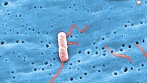 Die stäbchenförmigen Bakterien lösen die Legionärskrankheit aus. Gesunde stecken sich aber selten an. Foto: dpa