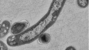 Der Tuberkulose-Erreger Mycobacterium tuberculosis. Foto: Robert Koch Institut/dpa