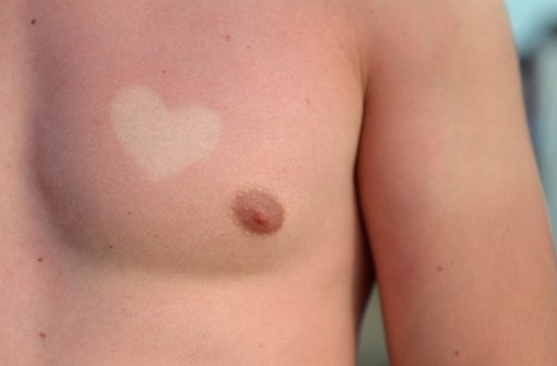 Als Liebesbeweis sind Sonnenbrand-Tattoos eine sehr ungesunde Idee. Foto: dpa-Zentralbild