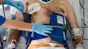 Auch bei Operationen am Herzen wird die Körpertemperatur teils abgesenkt (Symbolbild). Foto: picture alliance / dpa/Daniel Bockwoldt