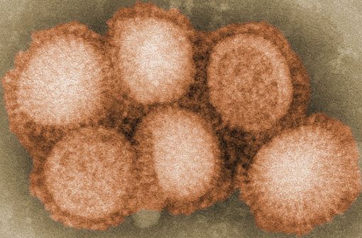Das Schweinegrippe-Virus H1N2 eine Art Mutation von   H1N1,  ein häufig umlaufender Subtyp der Human-Influenza. Foto: Wikipedia commons/Cybercobra/CDC-11214-swine-flu.jpg/CC BY-SA 3.0