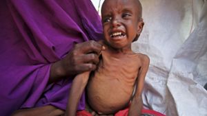 Ein Bild aus Somalia: Vor allem Kinder leiden wieder unter der Dürre dort. Foto: AP