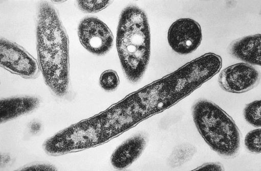Diese von den Centers for Disease Control and Prevention zur Verfügung gestellte elektronenmikroskopische Aufnahme aus dem Jahr 1978 zeigt Legionella pneumophila-Bakterien. Foto: dpa/Francis Chandler
