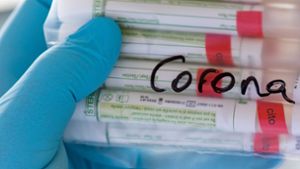 Tests auf das Coronavirus sollen in Bayern auch ohne Symptome möglich werden. Foto: dpa/Hendrik Schmidt