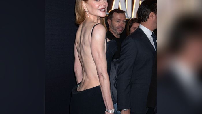 Nicole Kidman kommt halbnackt auf den roten Teppich