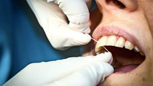 Professionelle Zahnreinigung ist eine Selbstzahlerleistung. Foto: dpa/Frank Rumpenhorst