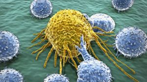 Eine Krebszelle inmitten weißer Blutkörperchen unter dem Elektronenmikroskop Foto: Fotolia