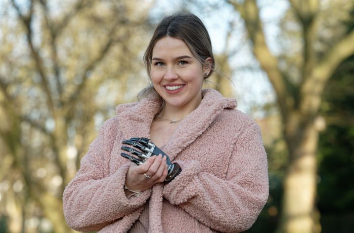 Wahl zur „Miss Germany“: Studentin mit Armprothese will Schönheitskönigin werden
