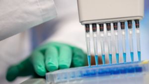 Test im Labor: In Bayern beispielsweise werden bereits Tests durchgeführt, die zeigen sollen, ob die Probanden bereits Antikörper gegen das Coronavirus um Blut haben. Foto: dpa/Sven Hoppe