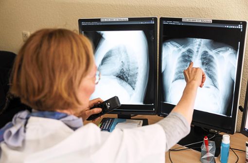 Eine Radiologin analysiert in ihrem Büro in der Lungenklinik Gauting die Röntgenbilder der Lunge einer aus der Ukraine geflüchteten Person. Die in der Pandemie stark belasteten Gesundheitsämter in Deutschland sehen sich angesichts der Ankunft von Flüchtlingen aus der Ukraine mit Zusatzaufgaben konfrontiert. Foto: Balk