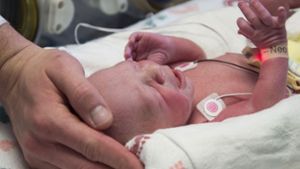 Experten sagten, die Verwendung der Gebärmütter von Frauen, die gestorben seien, könnte mehr Transplantationen möglich machen. Foto: Baylor University Medical Center