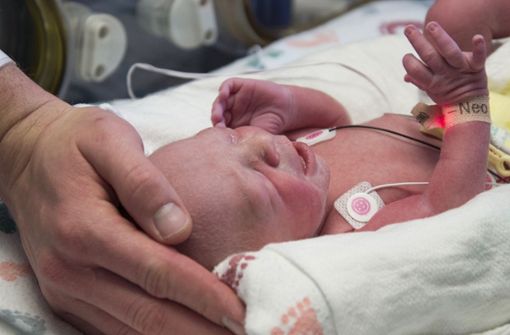 Experten sagten, die Verwendung der Gebärmütter von Frauen, die gestorben seien, könnte mehr Transplantationen möglich machen. Foto: Baylor University Medical Center