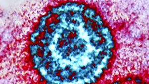 Das Virus in einer kolorierten Elektronenmikroskop-Aufnahme Foto: www.mauritius-images.com