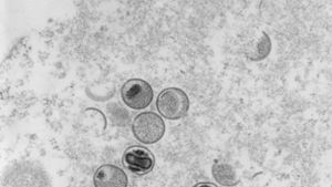 Laut den Forschern kann das Virus durch Sperma übertragen werden. Foto: dpa/Freya Kaulbars