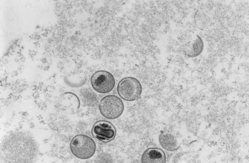 Laut den Forschern kann das Virus durch Sperma übertragen werden. Foto: dpa/Freya Kaulbars
