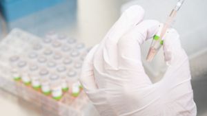 Eine biologisch-technische Assistentin bereitet PCR-Tests auf das Coronavirus im Niedersächsischen Landesgesundheitsamt für die Analyse vor. Der steigende Trend bei laborbestätigten Corona-Infektionen in Deutschland hält weiter an. Foto: dpa/Julian Stratenschulte