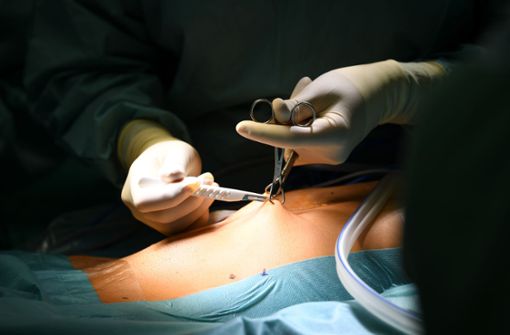 Ein Ärzteteam bereitet sich in einem Klinikum vor, den Darm eines Mannes zu operieren. Foto: Felix Kästle/