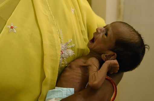 Ein unterernährtes Kind in Indien. Rund 15 000 Kinder unter fünf Jahren sterben nach Angaben der Vereinten Nationen jeden Tag auf der Welt. Foto: AFP