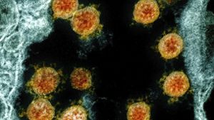 Diese elektronenmikroskopische Aufnahme des National Institute of Allergy and Infectious Diseases Integrated Research Facility (Fort Detrick,  US-Bundesstaat Maryland)   zeigt  Partikel des Coronavirus  (orangefarben), die von einem Patienten isoliert wurden. Foto: Uncredited/NIAID/NIH/dpa