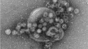 Elektronenmikroskopische Aufnahme von Noroviren Foto: dpa