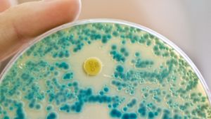 Multiresistente Keime, insbesondere der Acinetobacter baumanii, sind eine Herausforderung für die Krankenhäuser. Foto: dpa
