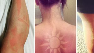 Viele schrecken vor der lebenslänglichen  Haltbarkeit bei Tattoos zurück – bei dem Instagram-Trend erübrigt sich dies. Foto: glomex