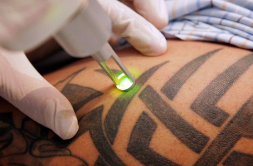 In Zukunft dürfen nur noch Ärzte Tattoos mit dem Laser entfernen (Symbolbild). Foto: dpa
