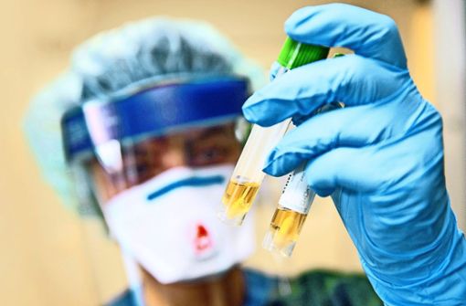 Nicht jeder, der hustet oder niest, hat sich mit dem Coronavirus infiziert. Im Zweifelsfall bringt ein Test im Labor Klarheit. Foto: dpa/Bernd Thissen