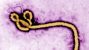 Eine Krankenschwester aus Italien ist mit Ebola infiziert.  Foto: CENTERS FOR DISEASE CONTROL AND