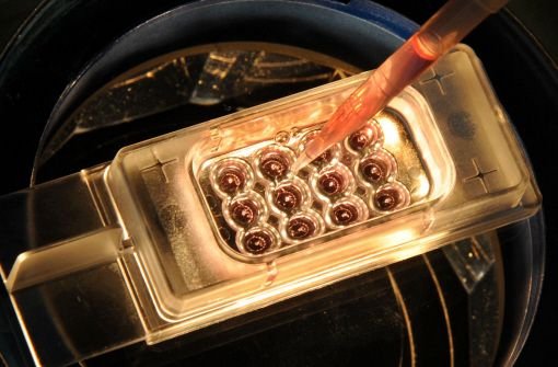 Paare mit problematischen Gen-Anlagen können ihre Embryonen aus dem Reagenzglas bald mit Gentests auf schwere Defekte untersuchen lassen. Foto: dpa