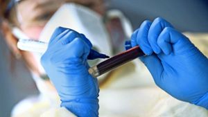 Eine Mitarbeiterin des Robert-Koch-Instituts (RKI) beschriftet eine Blutprobe. Für Corona-Tests zahlen bisher die Kassen, für Beatmungsgeräte der Staat. Foto: dpa/Marijan Murat