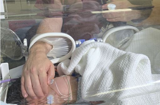 Das Neugeborene steht derzeit in einer Klinik unter Beobachtung und wird behandelt. Foto: AP