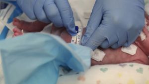 Normalerweise kann man den Großteil der Defekte am Kinderherzen schon während der Schwangerschaft im Ultraschall erkennen. Nach der Geburt werden die Kinder dann recht schnell operiert. Foto: AP