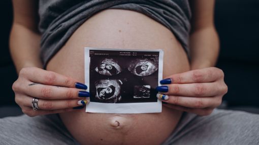Eine werdende Mutter zeigt Ultraschallaufnahmen des heranwachsenden Babys in ihrem Mutterleib. (Symbolbild) Foto: IMAGO/Pond5 Images/IMAGO/xfentonromax