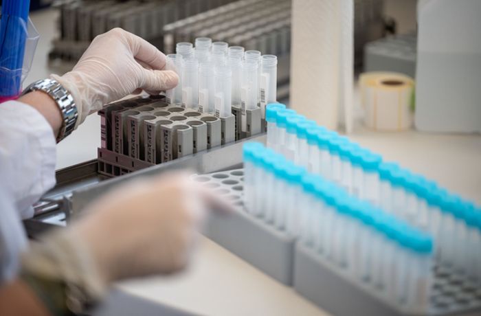 PCR-Tests in Stuttgart: Intern werden die PCR-Tests beim Auswerten bereits priorisiert
