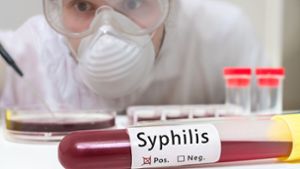 Das RKI betont, dass es bisher keinen Impfstoff gegen Syphilis gibt –  und wohl auch nicht geben wird. Foto: vchalup - stock.adobe.com