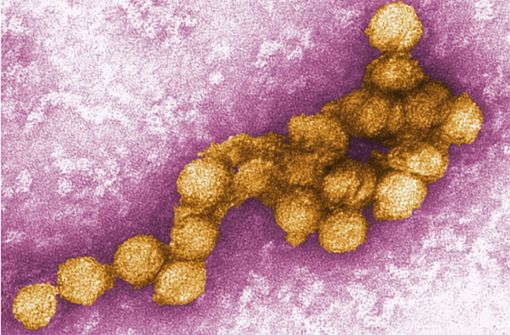 So sieht der West-Nil-Virus unter dem Elektronenmikroskop aus. Foto: dpa