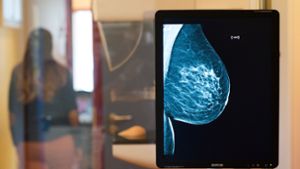 Röntgenbilder wie dieses von einer Mammografie waren im Internet frei zugänglich. Foto: dpa/Klaus-Dietmar Gabbert