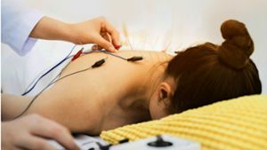Akupunktur ist ein wichtiger Bestandteil  der chinesischen Medizin. Foto: /Adobe Stock/phat1978
