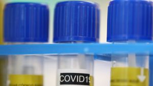 Die Wissenschaftler untersuchen derzeit, ob Nikotin vor dem Coronavirus schützen kann (Symbolbild). Foto: dpa/Denis Balibouse