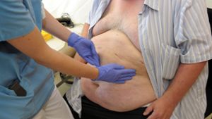 Als adipös gilt in Deutschland ein Mensch mit einem Body-Maß-Index (BMI) von 30 oder mehr. (Symbolbild) Foto: picture alliance / dpa/David Ebener