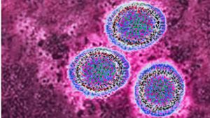 Influenza-Virus unter dem Elektronenmikroskop. Foto: Imago/BISP