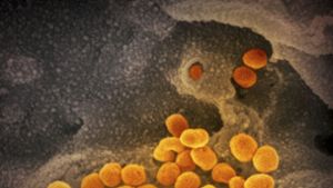 Eine mikroskopische Aufnahme  zeigt das Coronavirus (SARS-CoV-2). Nun soll es eine neue Variante des Virus geben (Symbolfoto). Foto: NIAID-RML/AP/dpa